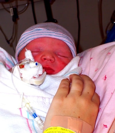 noahNICU
